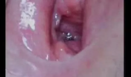 골 후커 포르노 항문 체코